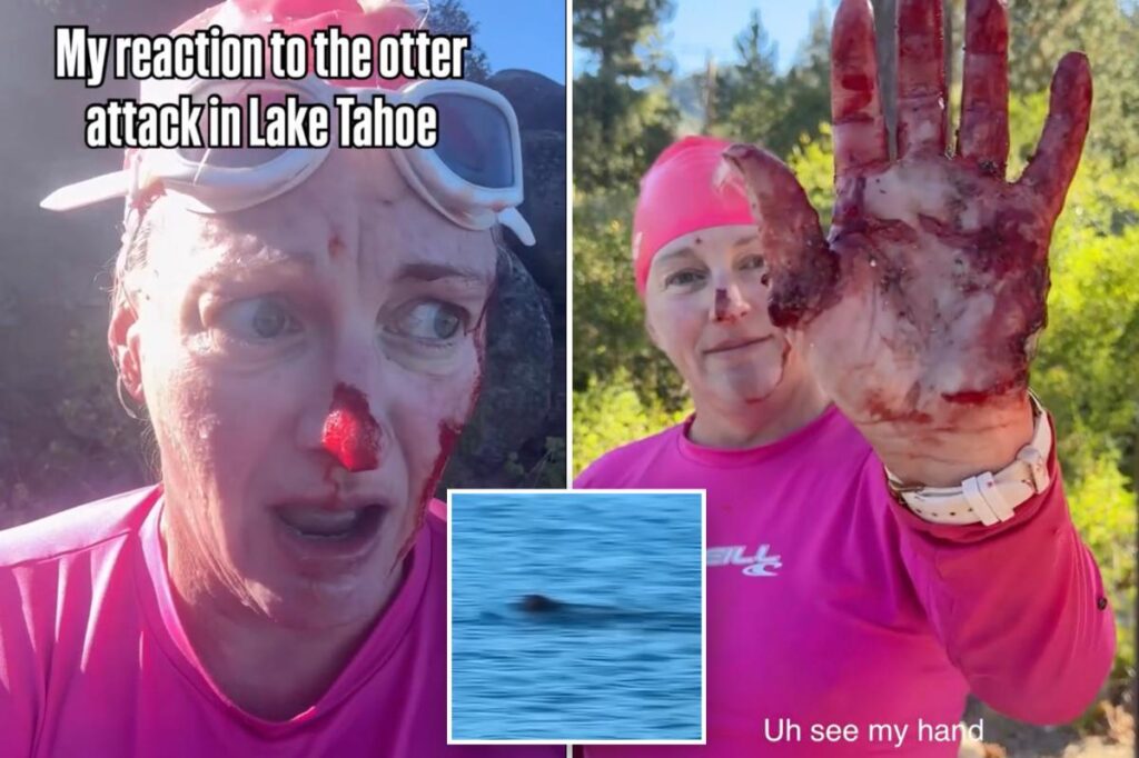 Swimmer mauled in vicious attack by ‘ruthless’ river otter: ‘It just kept coming’