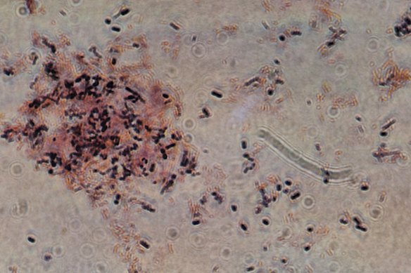 Clostridioides difficile under the microscope.