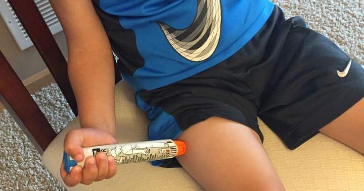 Food allergy education a must as kids head back to school, doctors say